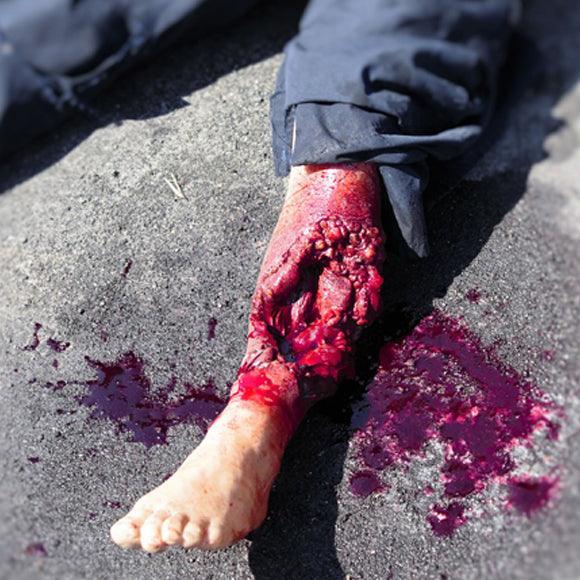 WW3-752 Gedeeltelijke Beenamputatie Simulatie met Bloedfunctie